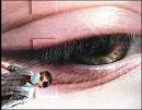 sarseye picture